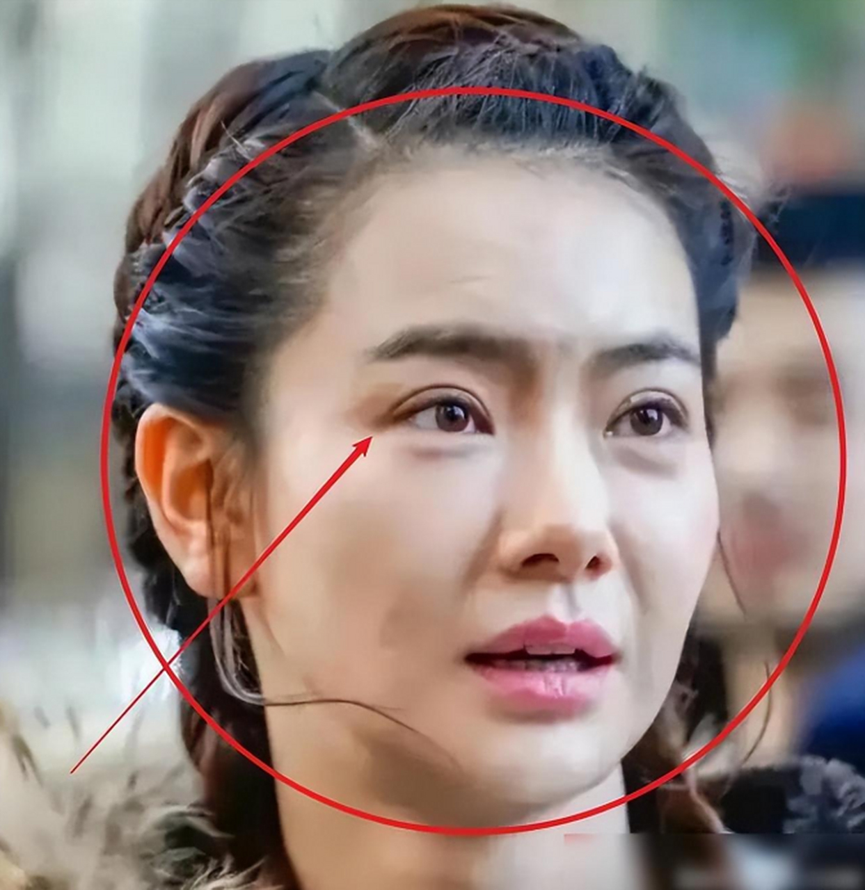 最令大众喜欢的就是戚薇,而且她的整容是众所周知的,戚薇自己也承认她