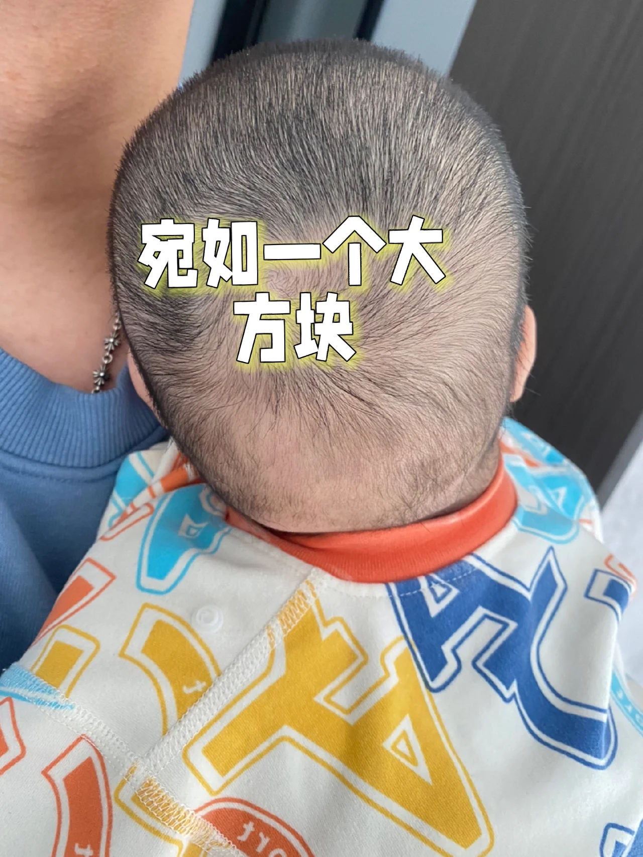 五个半月宝宝方颅了~ 现在抱着想捶死自己的心情,写了这篇帖子