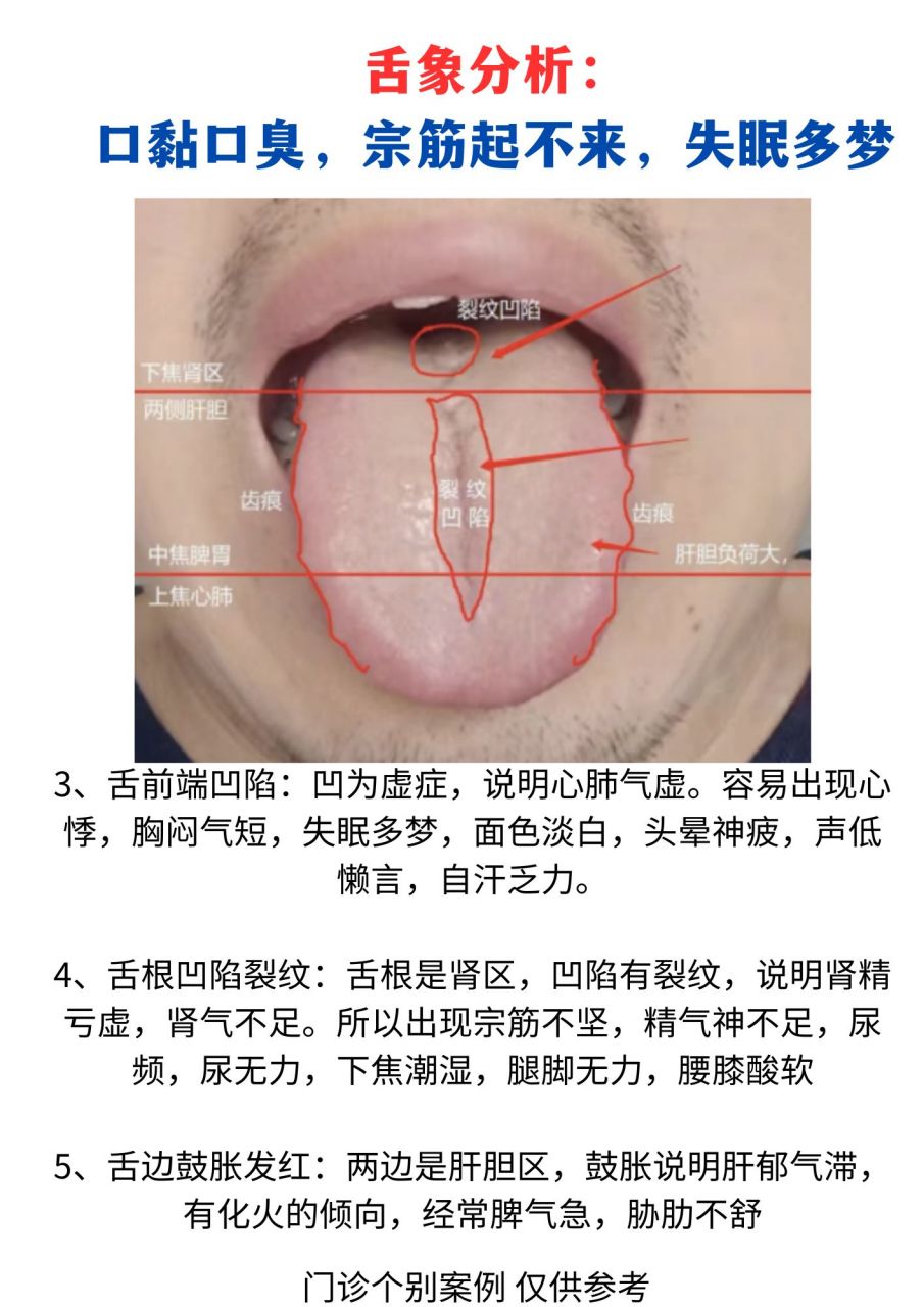 中医36种舌象图解儿童图片