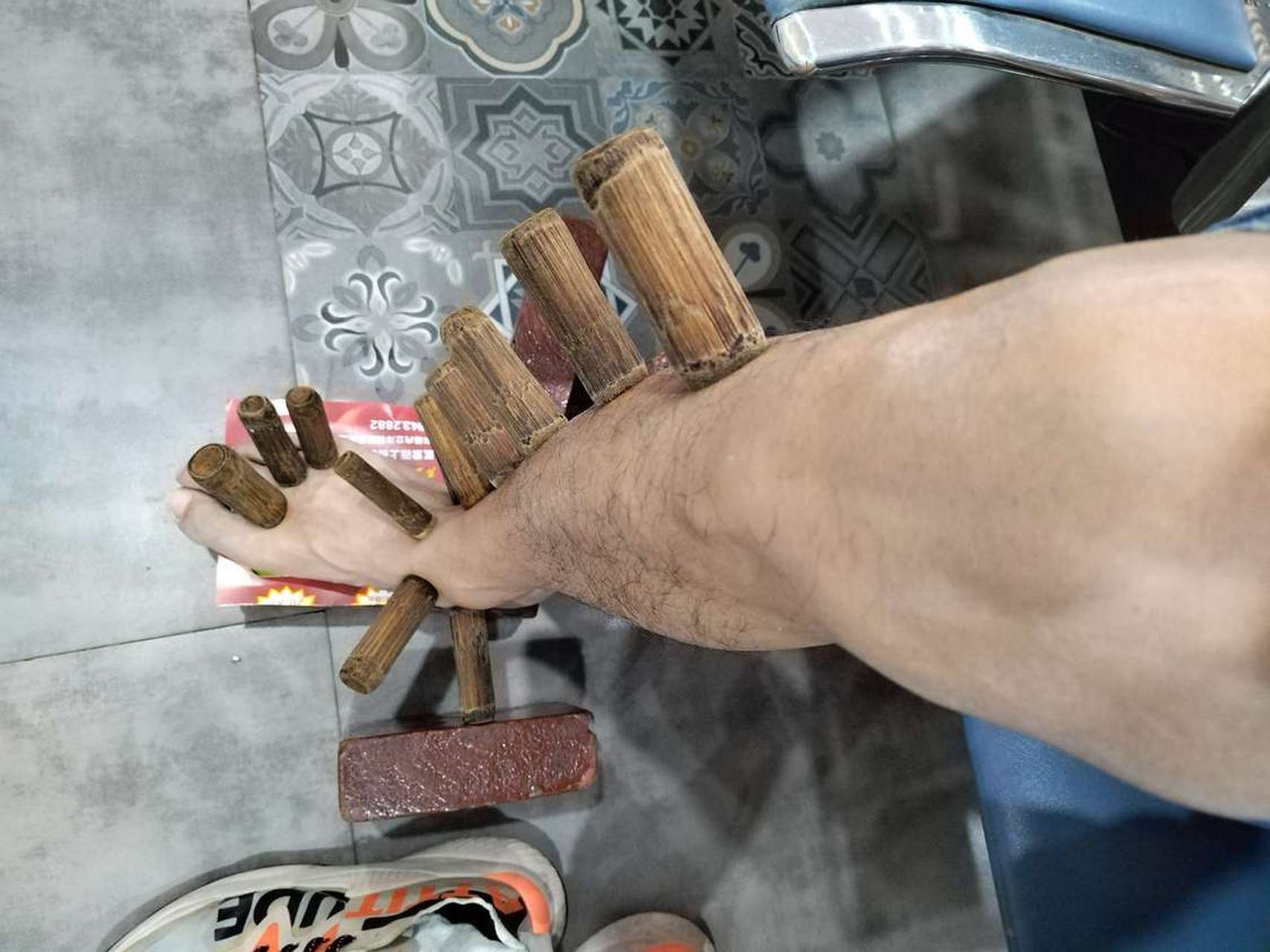 脚没知觉了,直接给我用银针一扎一出门好了,啥事没有了,中医真牛