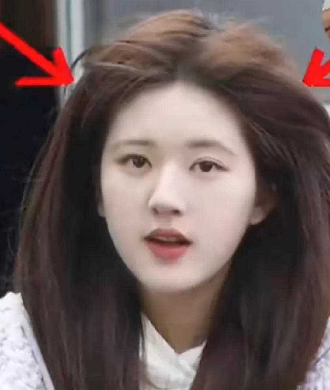 赵露思你这头发,前天晚上是去打罗了吗,养发方法如下: 1,按摩五分钟