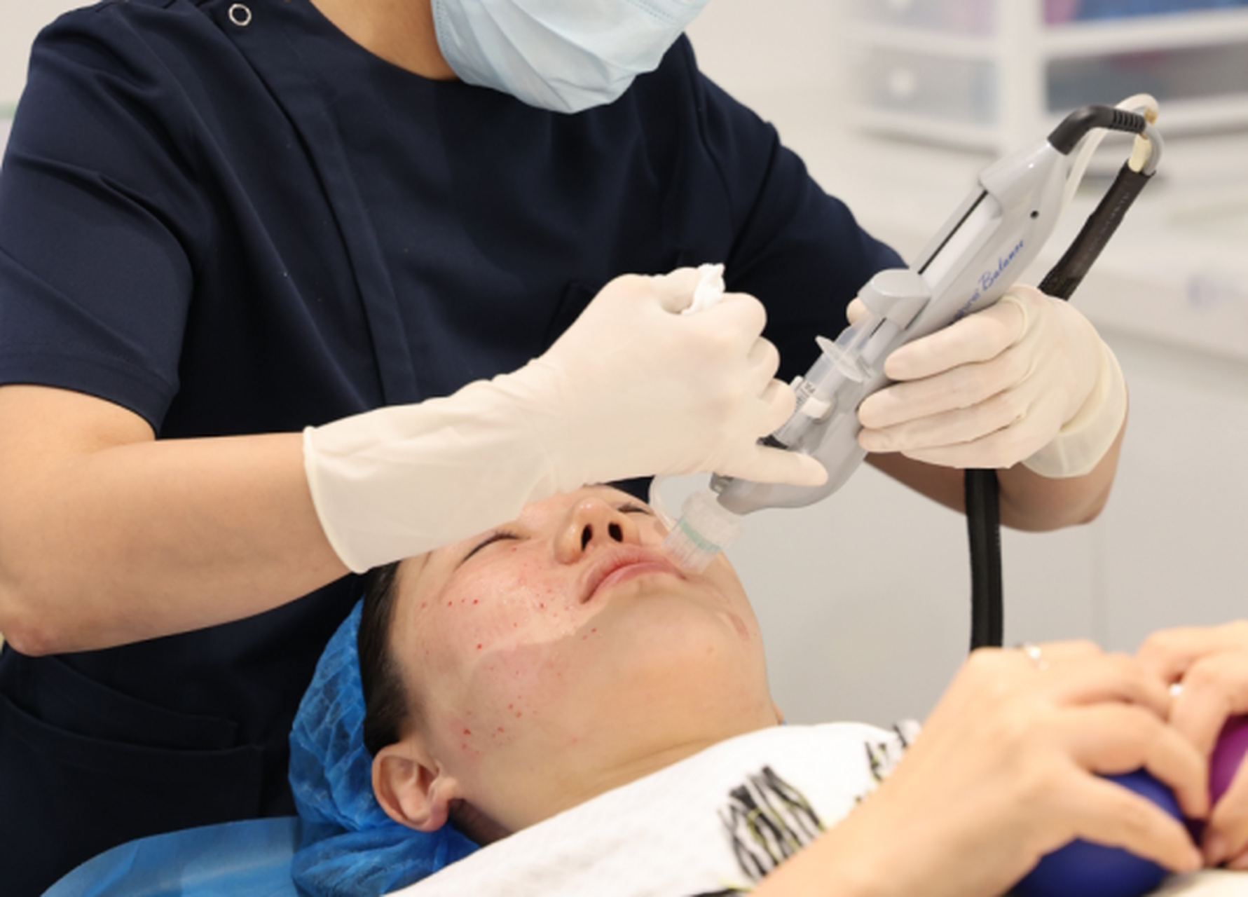 关于#水光针# 注射"漏药"问题  不少求美者都听说机打水光漏药多,而