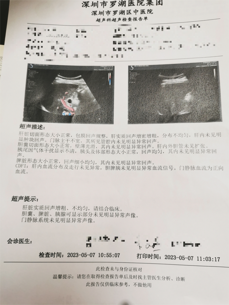 肝脏好不好,去医院做什么检查可以少花钱,不踩坑?