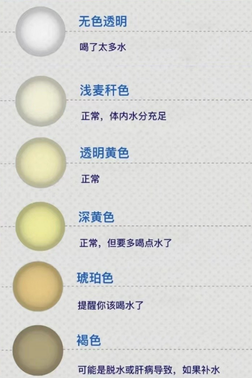 1,淡黄色:正常人的尿液是呈现淡黄色,若是尿液颜色发生改变,也就是就
