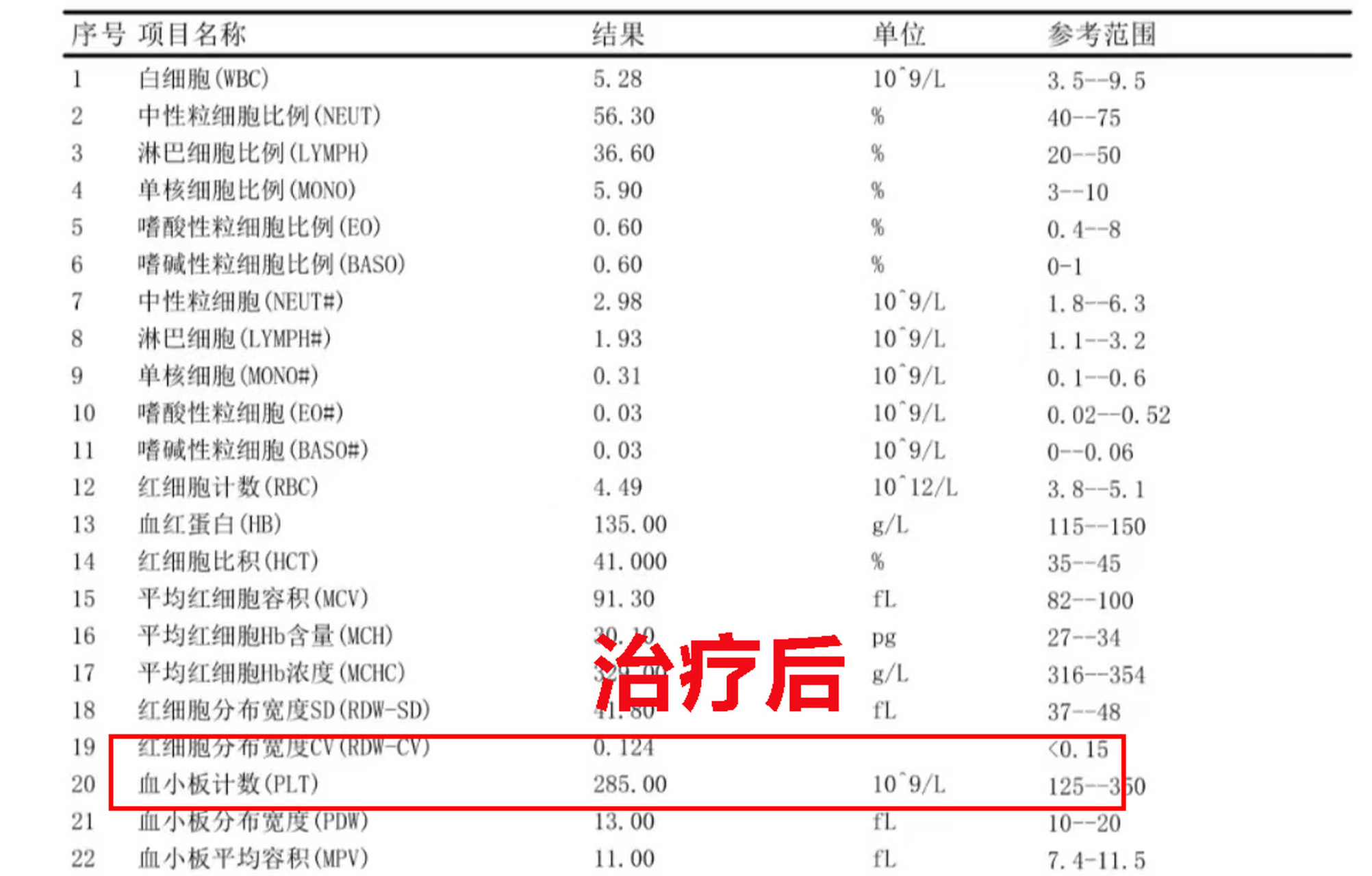 血小板偏高是什么原因图片