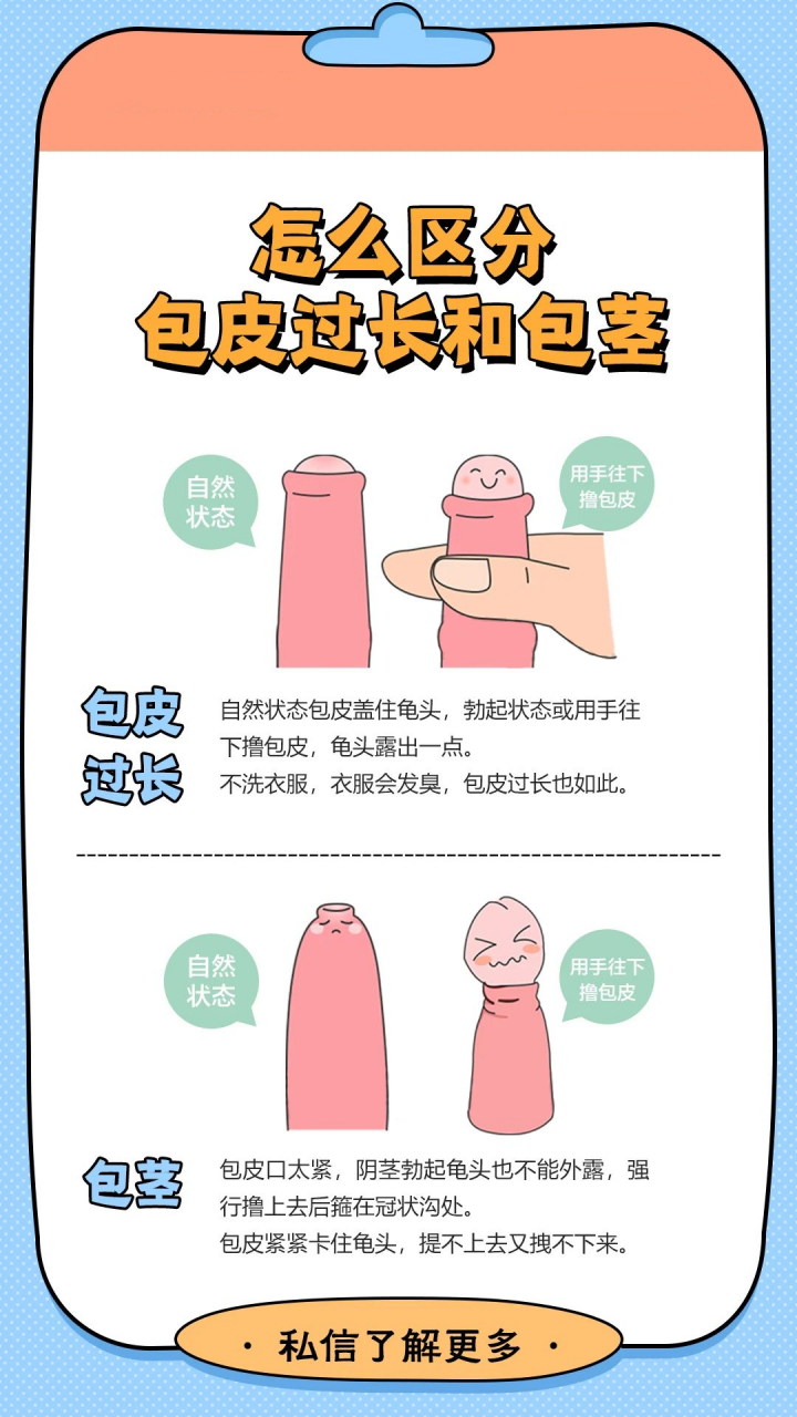 包皮过长#  #包茎#   #泰州东方医院# #泰州东方男科检查58元# #讨葺