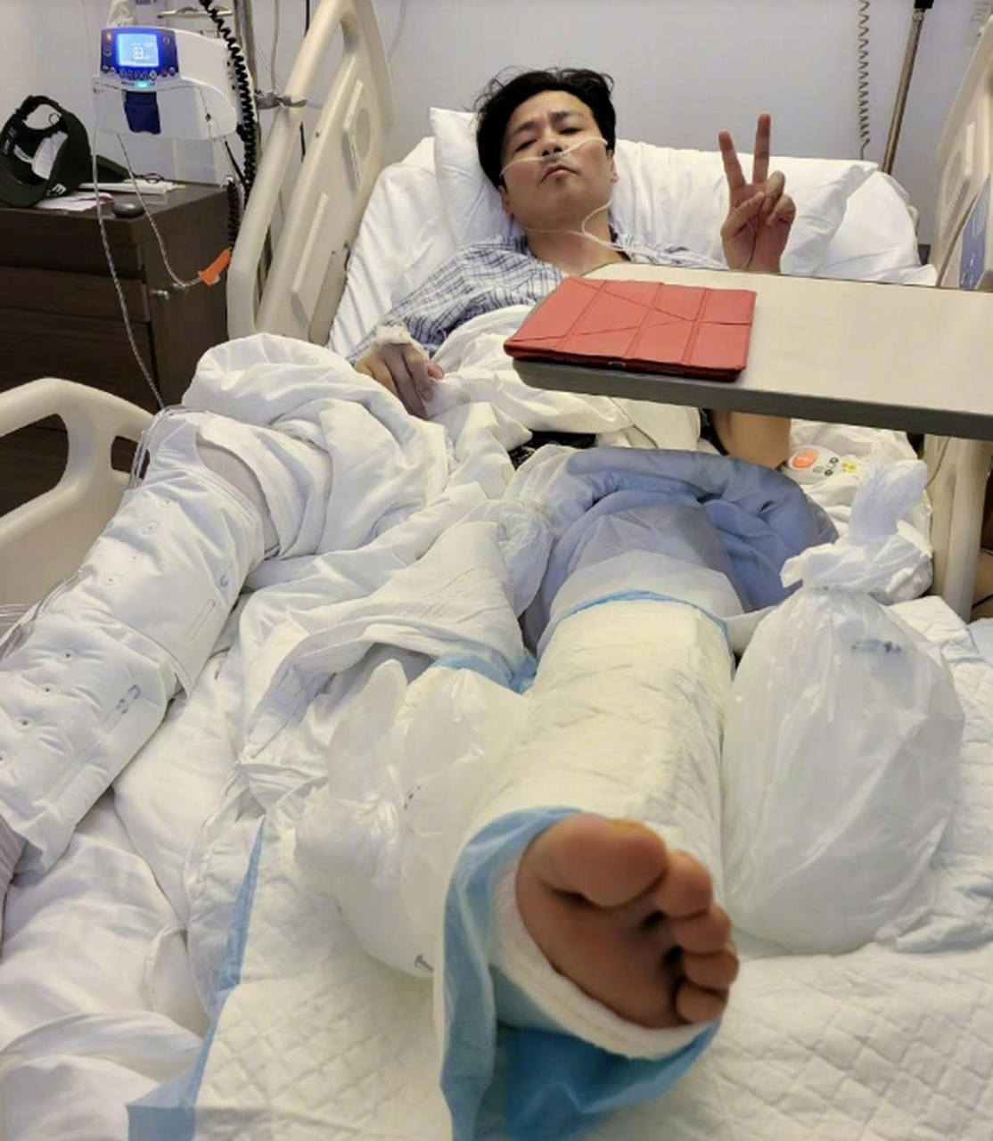 蔡少芬老公张晋拍戏受伤进医院,脚上打了石膏,却努力对镜头比耶,心态