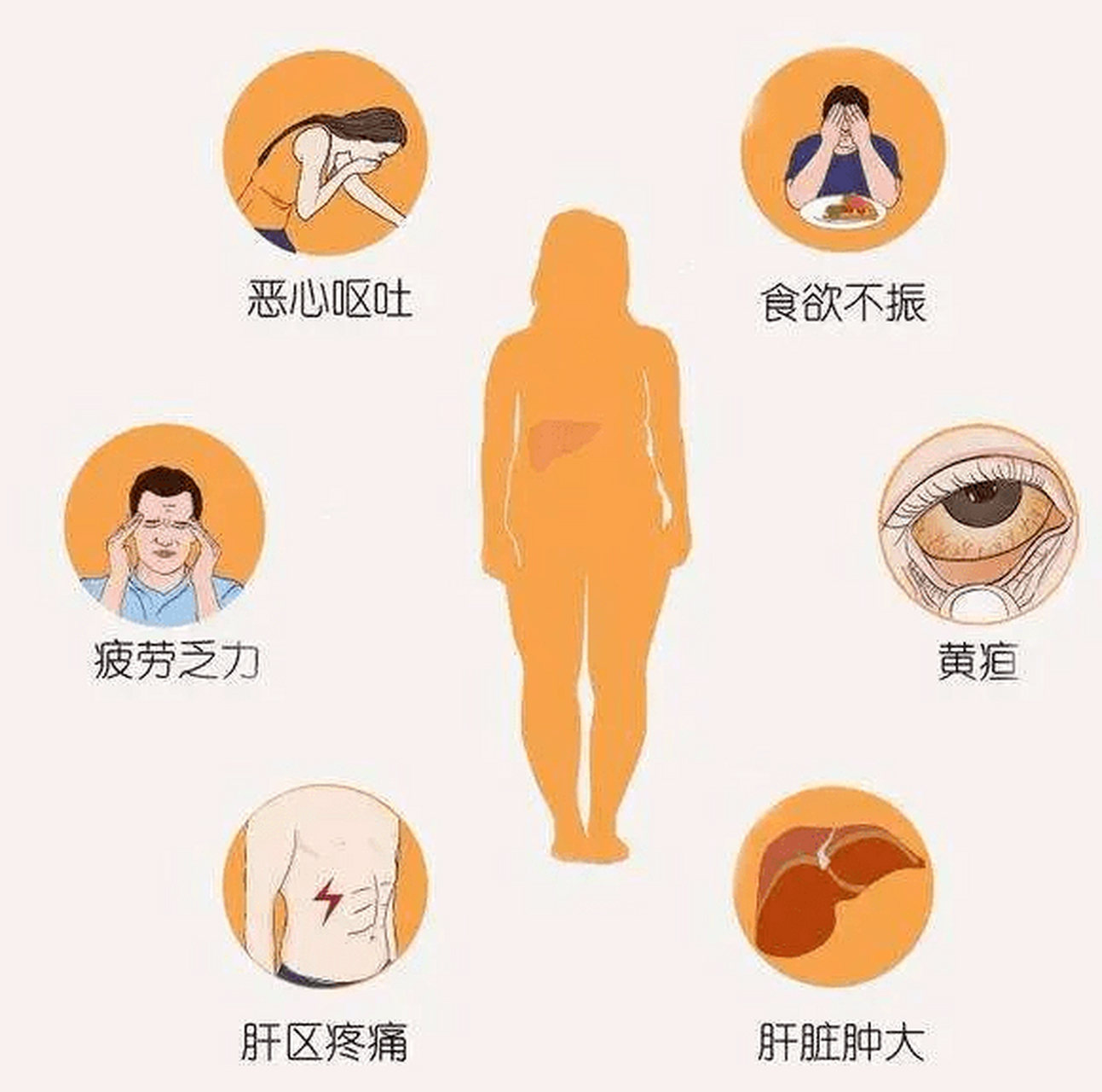 【中医笔记】肝硬化早期症状是食欲减退和乏力,可伴腹胀,厌油,恶心