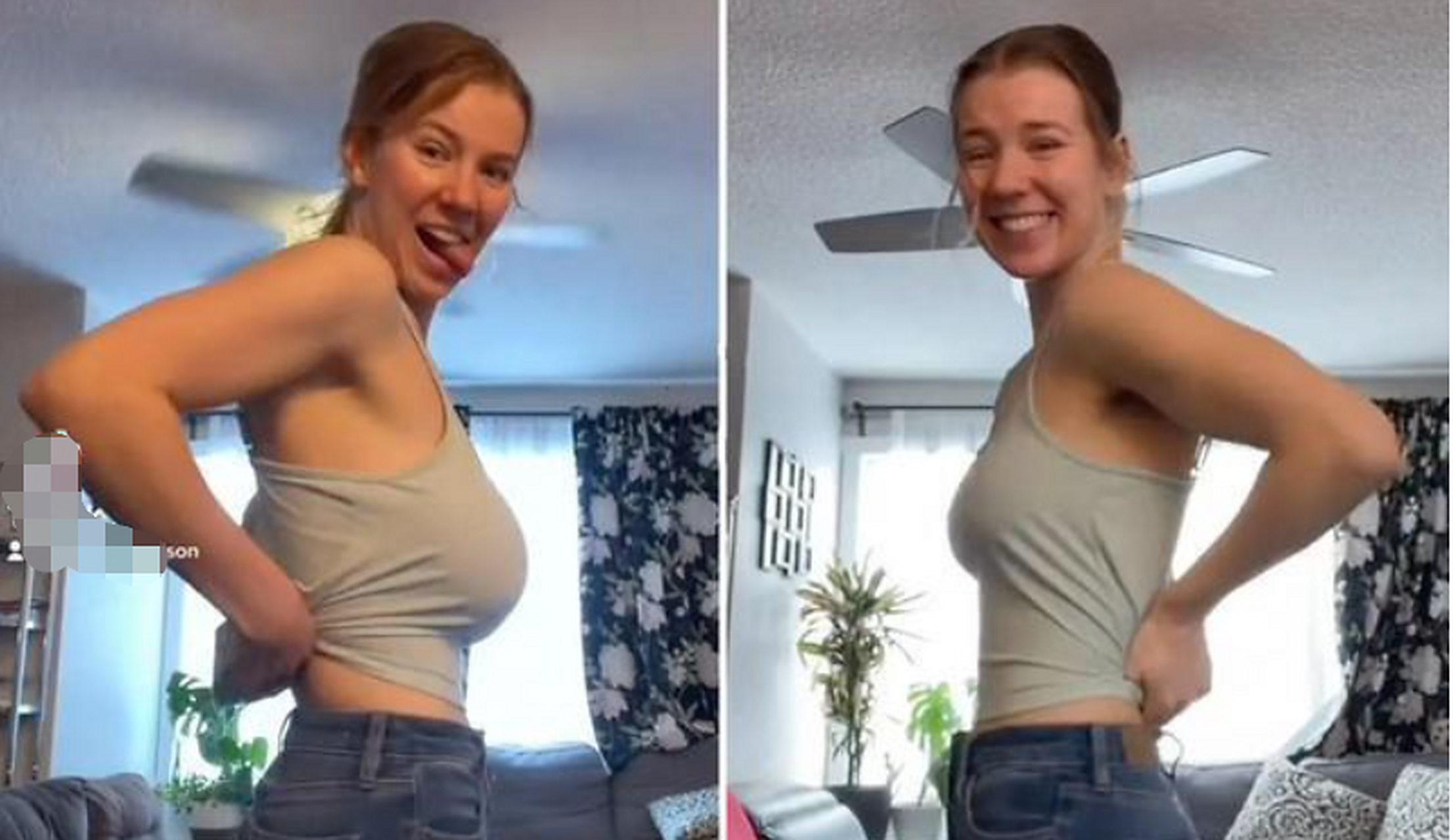 关于缩胸手术,理论上来说十八岁以上的人,如果受到大胸问题的困扰,都