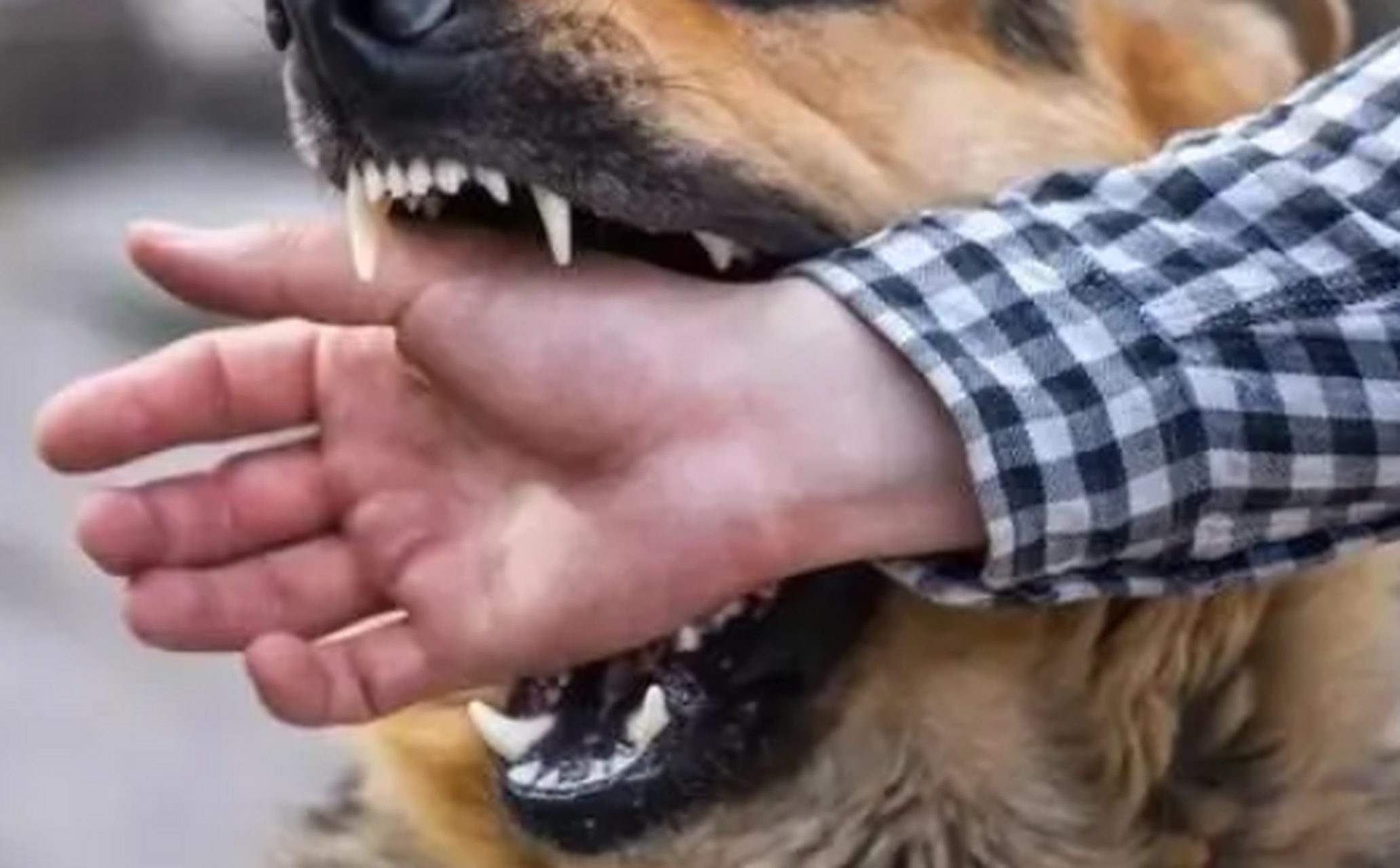 痛心!男孩被狗抓伤患狂犬病20天后死亡,家属:未做相应处理!