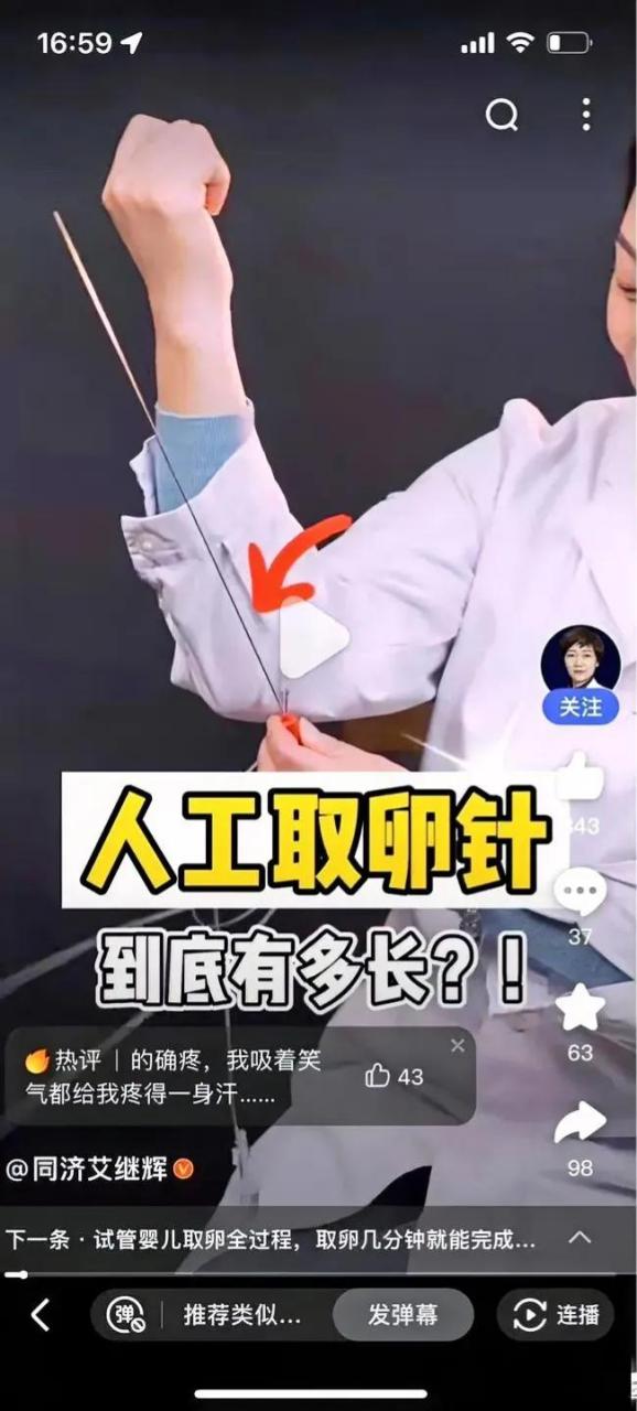 取卵针这长度是不是到胃部了? 第一次见吓我一跳,跟前臂一样长!