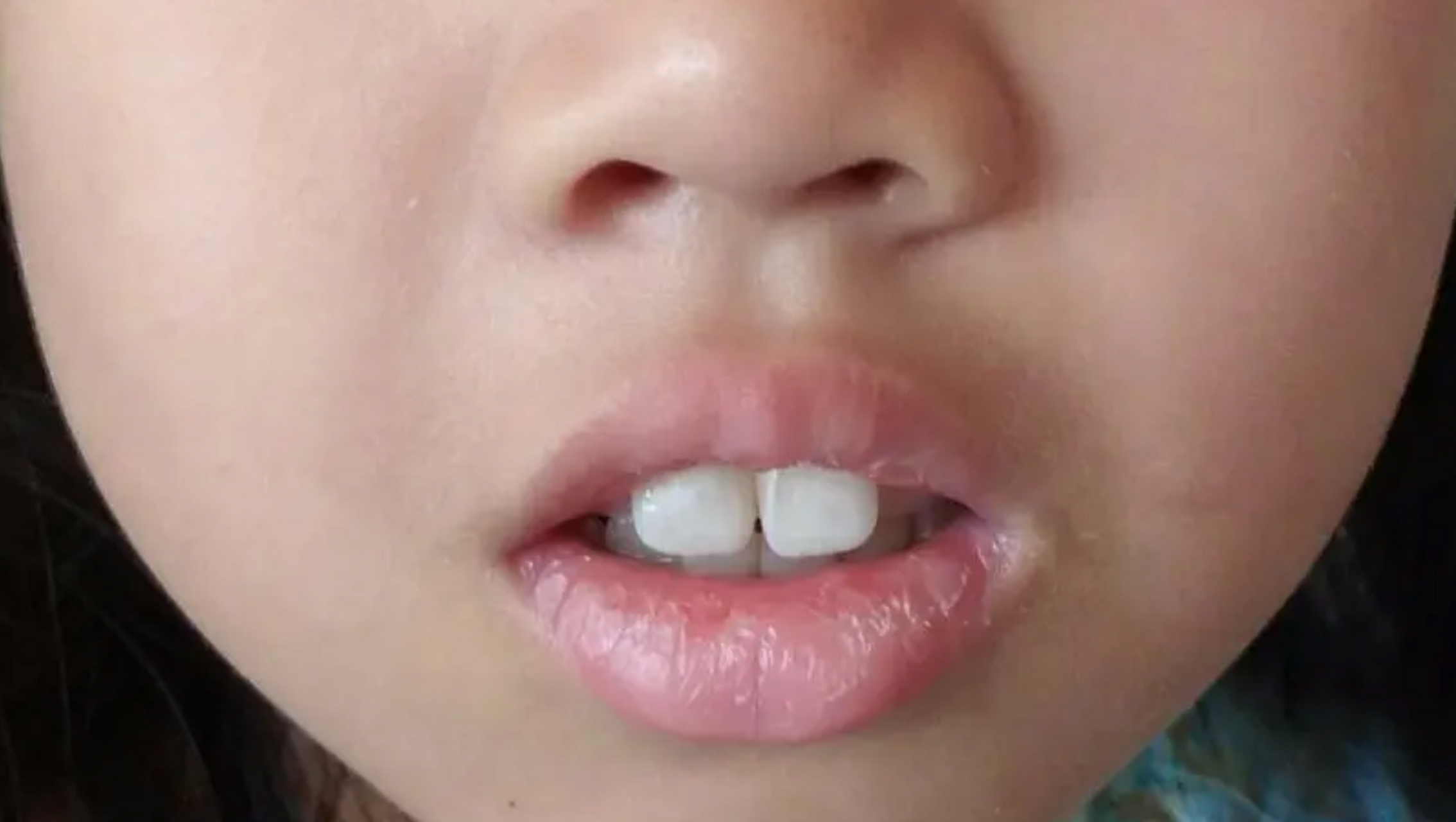 我们发现,腺样体肥大的孩子,学习成绩总比别人差,这是什么原因呢?