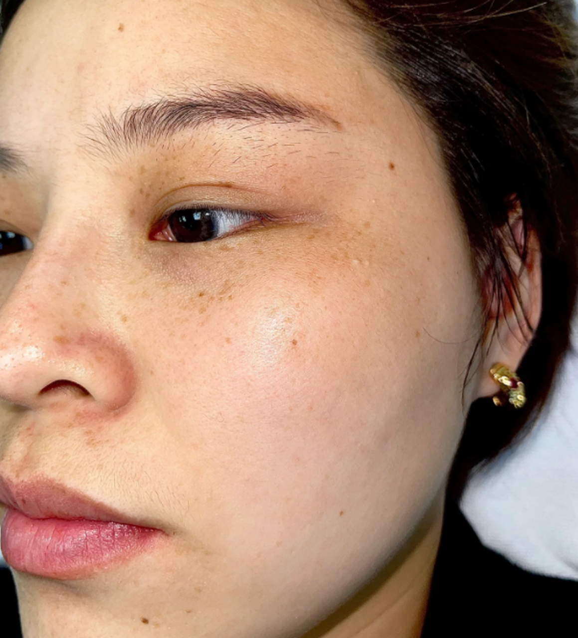 对于我来说,预防晒斑比淡化晒斑更为重要,那么,如何应对夏季晒斑呢?