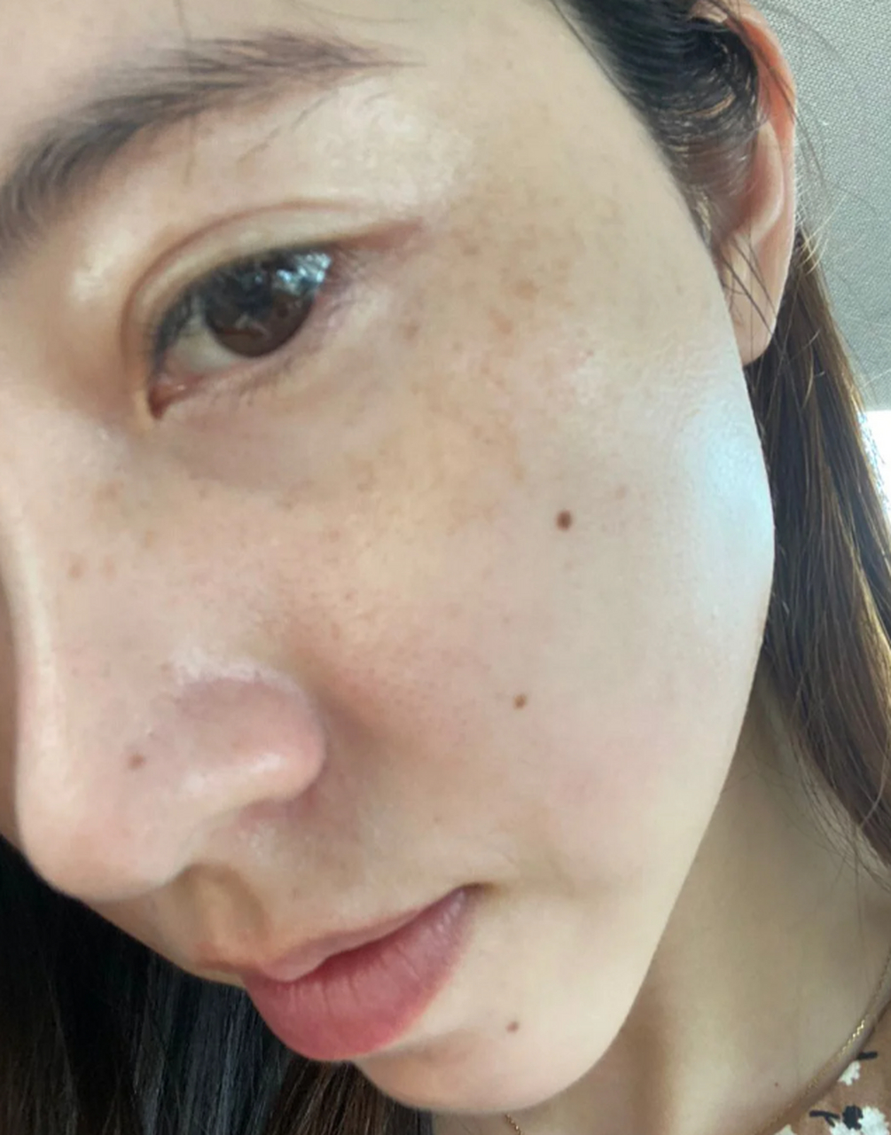 那么脸上有黄褐斑怎么排毒最有效呢?