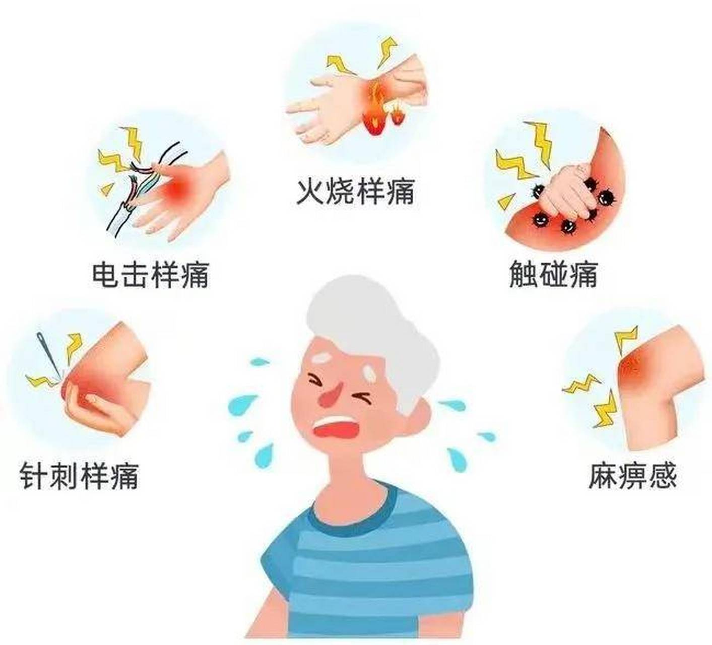 带状疱疹的早期症状有哪些?