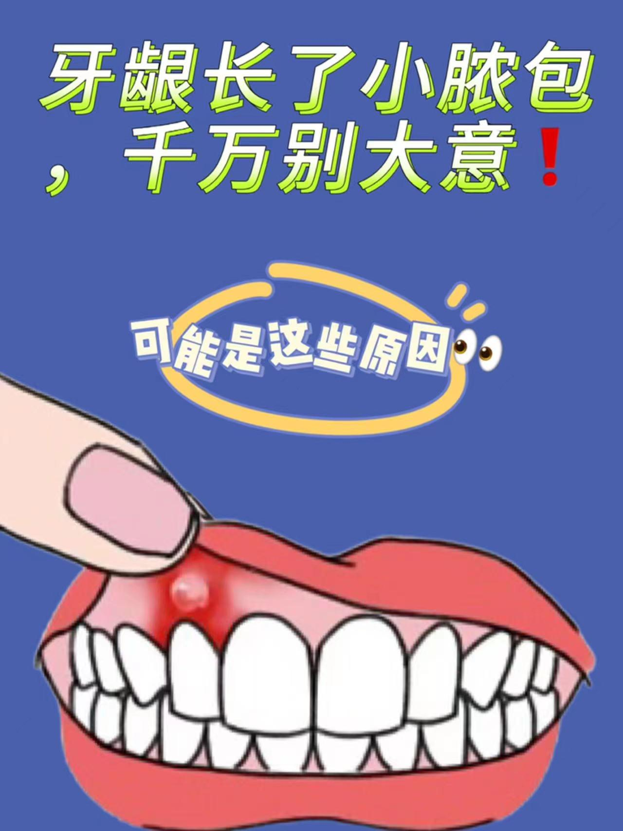 牙龈长了小脓包,千万别大意可能是这些原因  如果牙龈长了一个小脓包