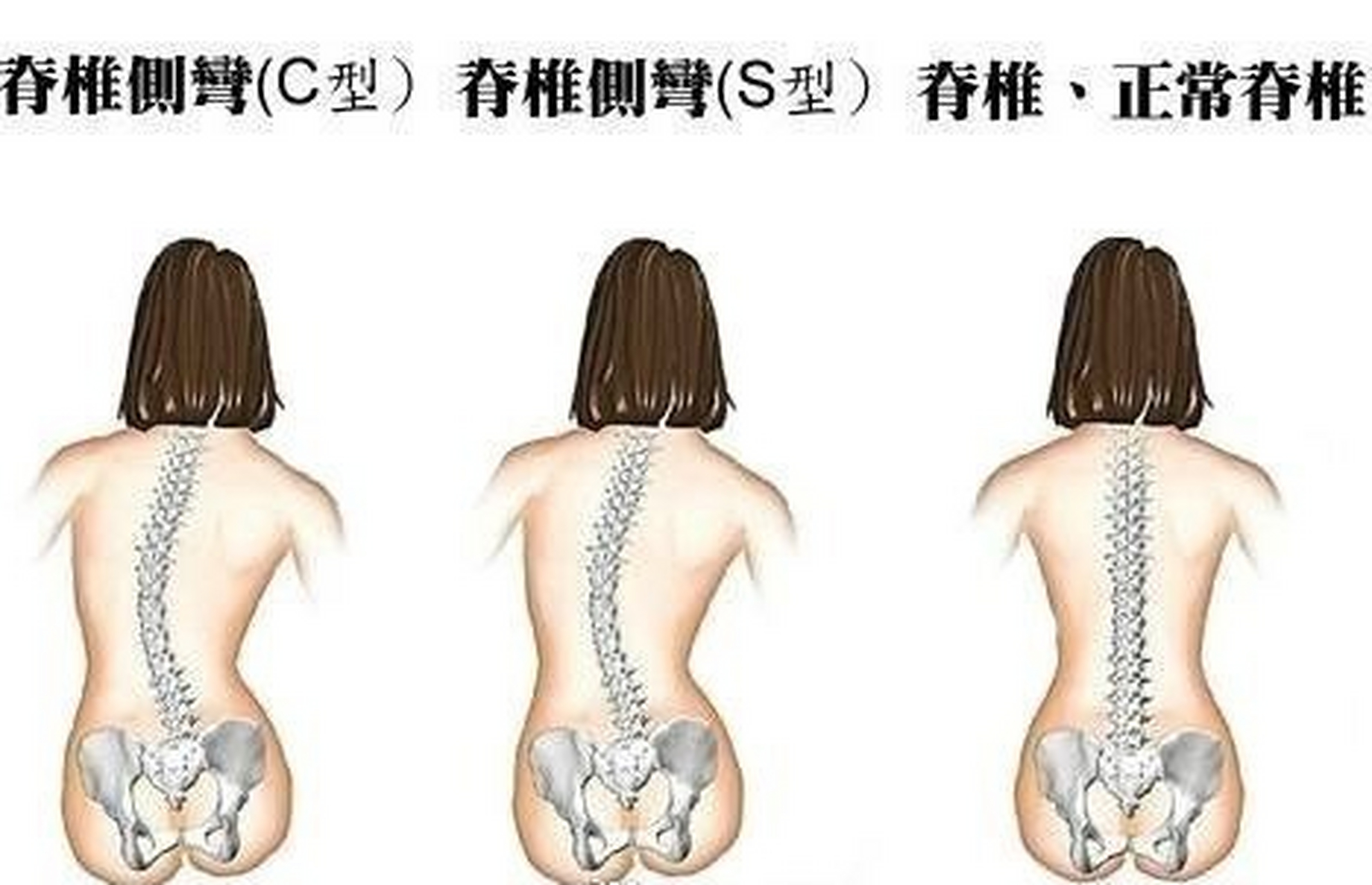 跷二郎腿的脊柱图片图片