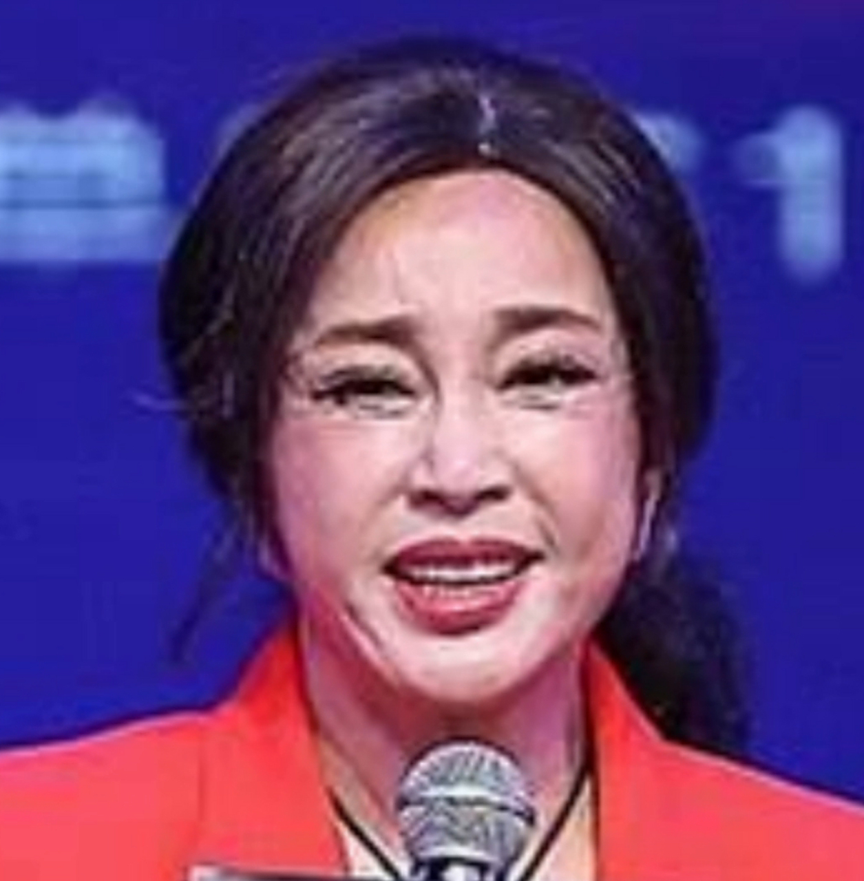 刘晓庆用实际行动告诉我们,千万不要轻易尝试创伤性大的项目,拉皮是