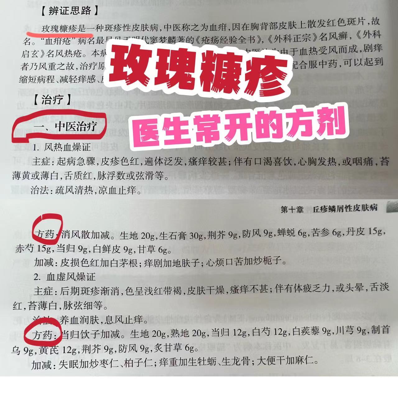 门诊上也有很多玫瑰糠疹的病人,反反复复,大家很是苦