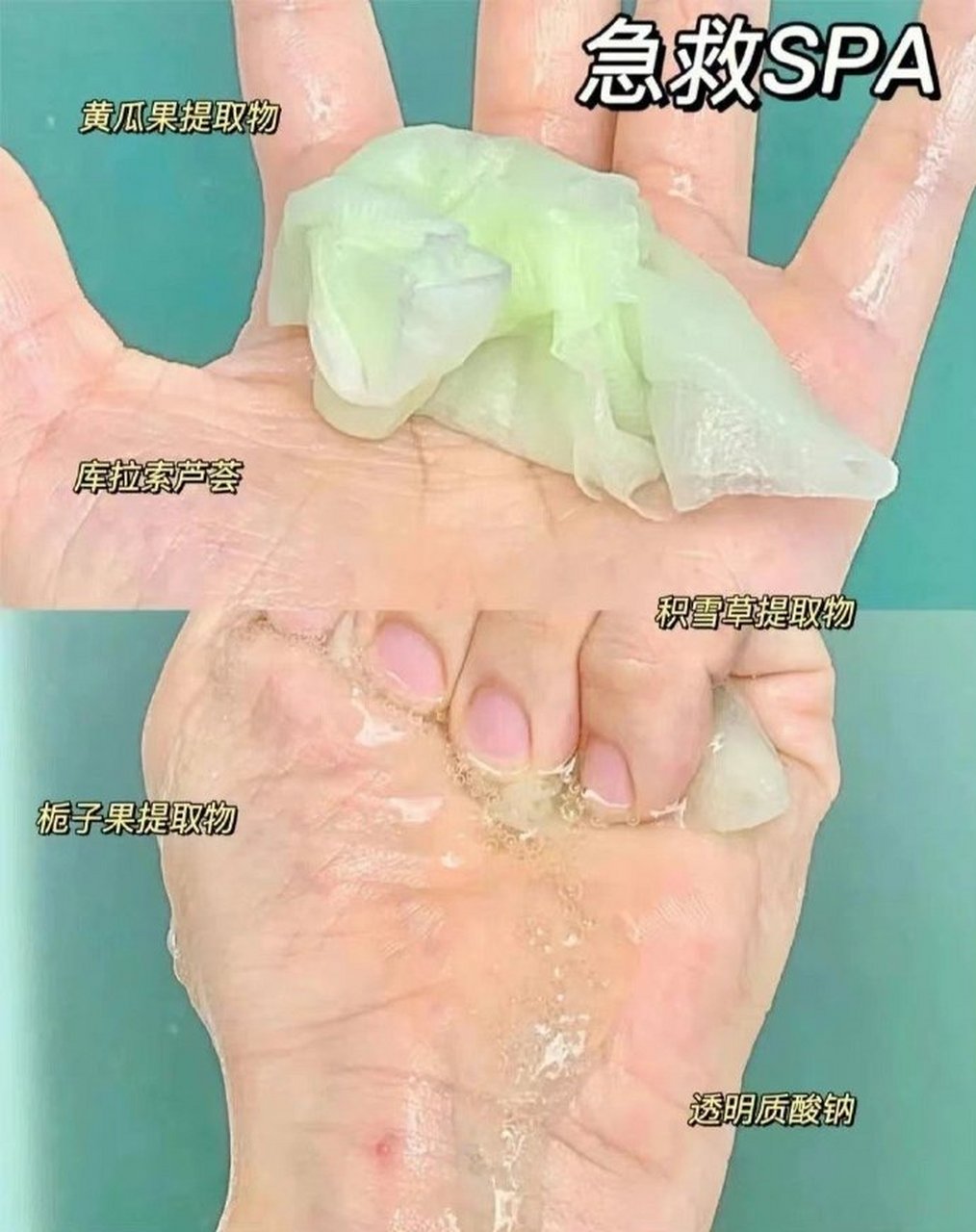 斐思妮 医用冷敷贴 主打保湿修护,镇静舒缓,修护亮肤哒  #时尚年货好