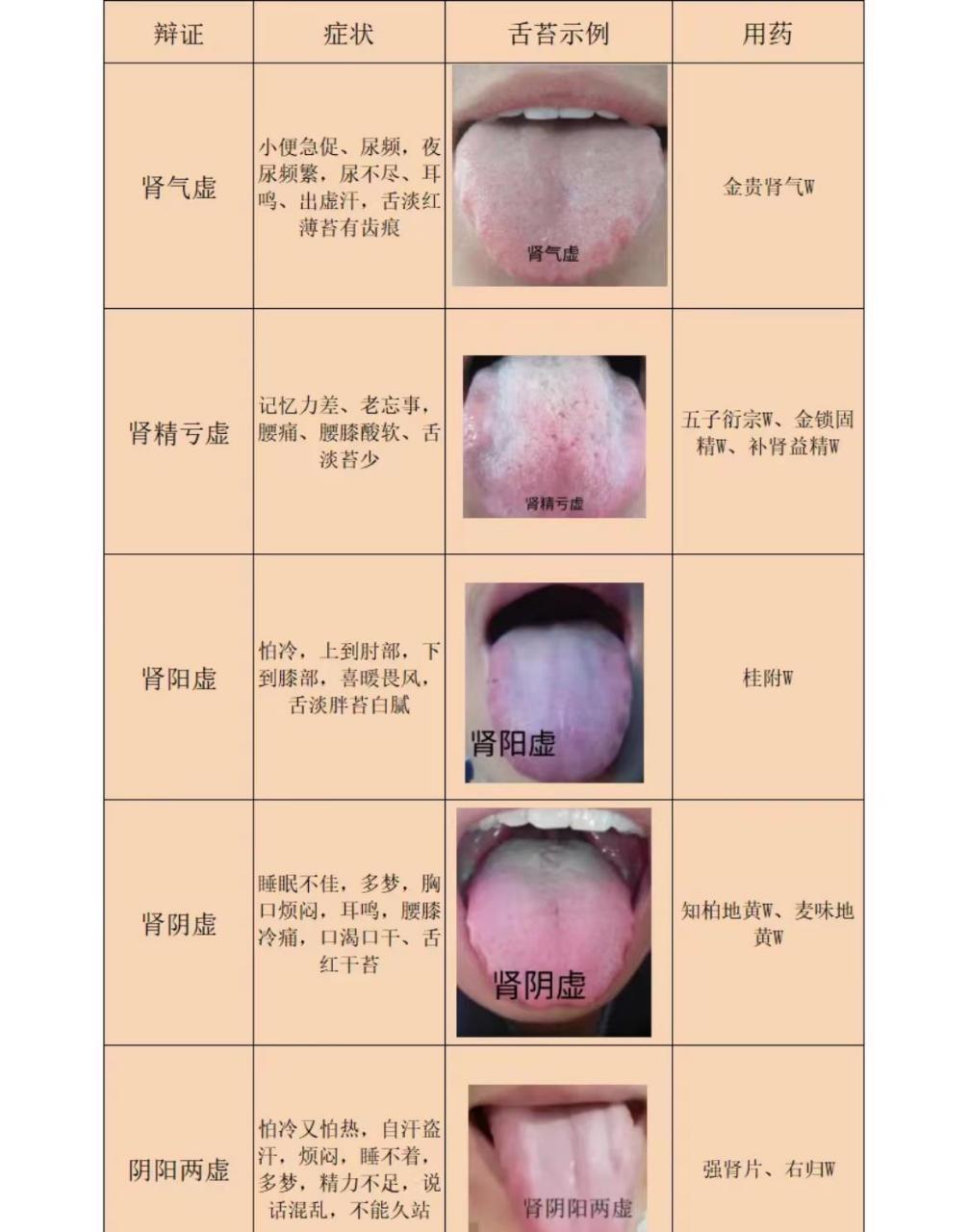 舌苔病症大全图解图片