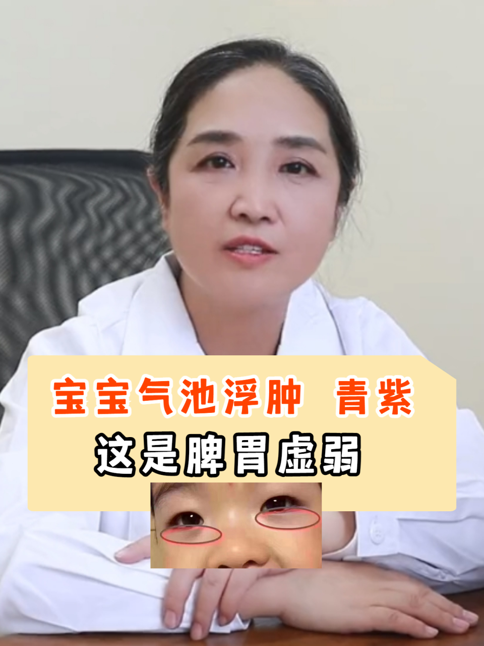 孩子气池浮肿,青紫一一脾胃虚弱  "气池"就是我们常说的下眼睑 (眼袋)
