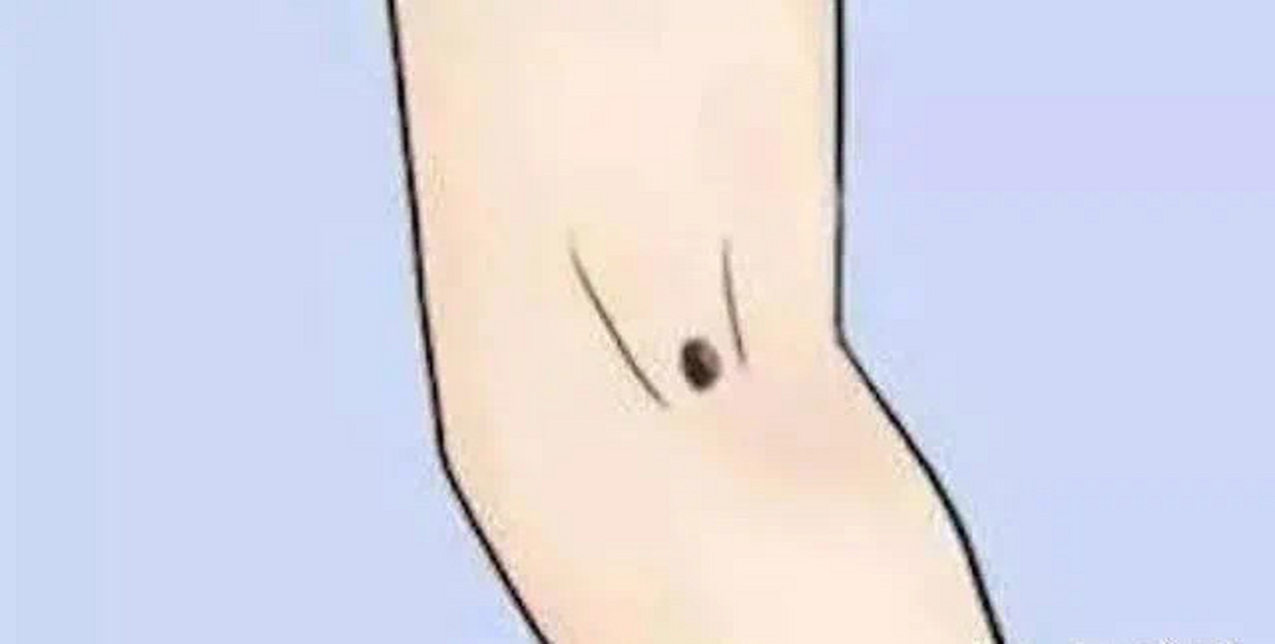 手臂内侧有痣:  手臂内侧有痣也是富贵的象征.