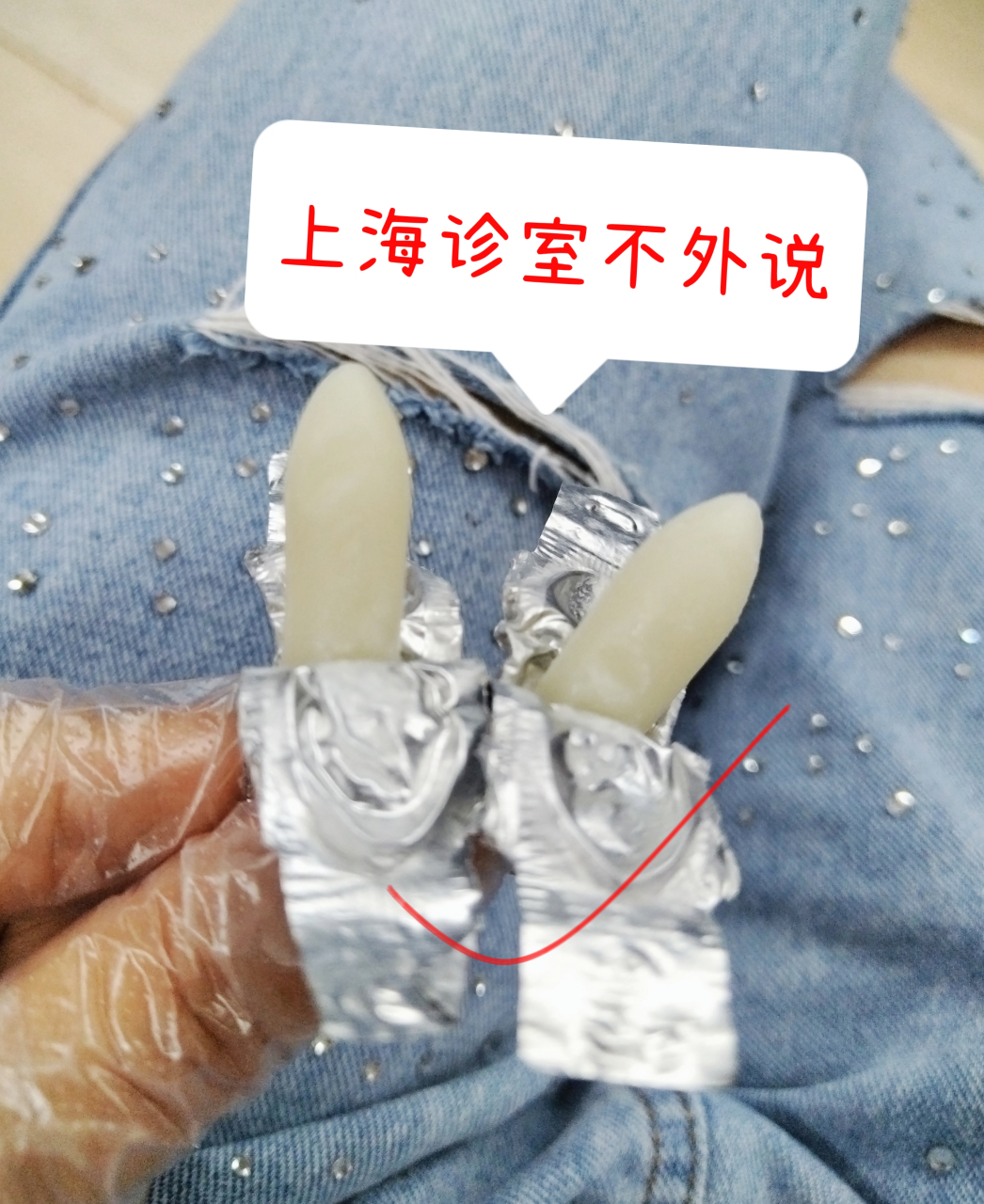上海医院流出的妇科"一绝药"  【1】——金刚藤胶囊 什么情况下用