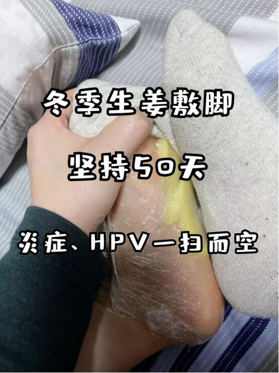 冬季生姜敷脚,坚持50天,炎症,hpv一扫而空#hpv#健康养生#健康科普