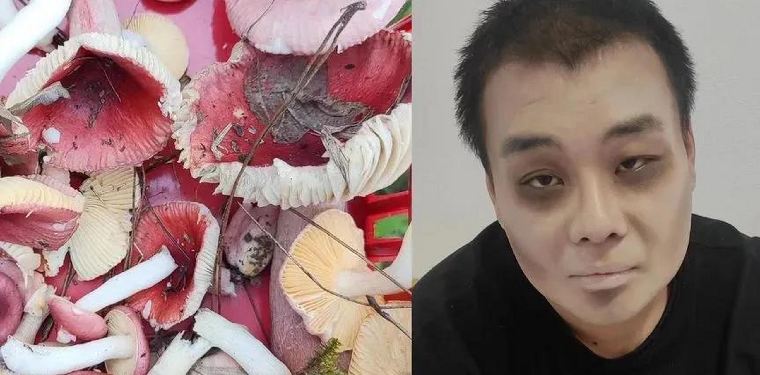 【男子上山采野生蘑菇,"大杂烩"吃完中毒,面色发白变成"僵尸"妆】4月