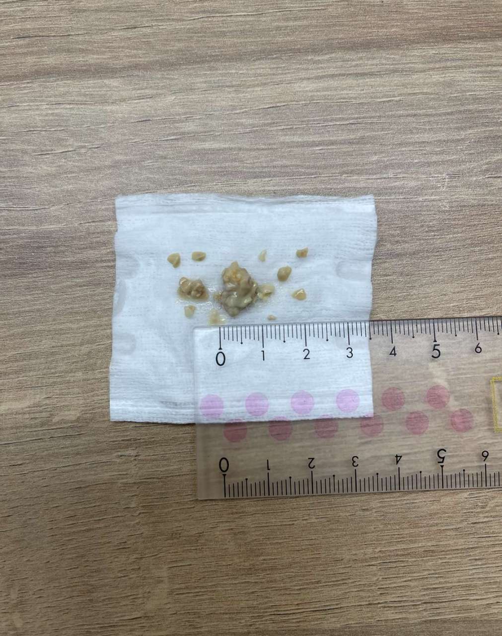 今天喉咙不舒服抠出这玩意儿