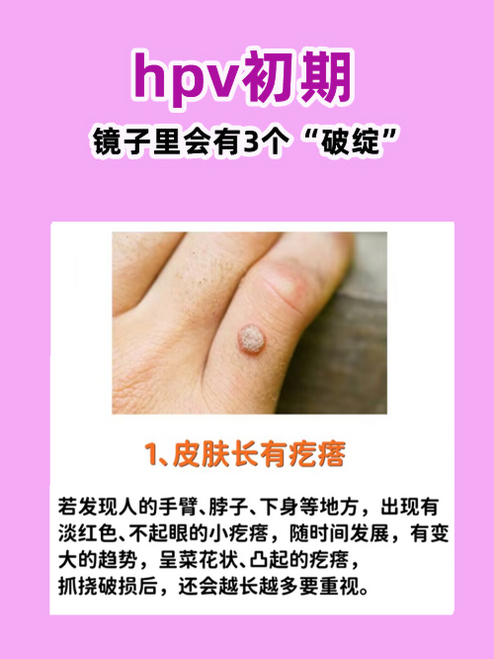 1,大腿内侧发黑 2,皮肤痒 3,皮肤长有疙瘩 - hpv初期,身体可能不会