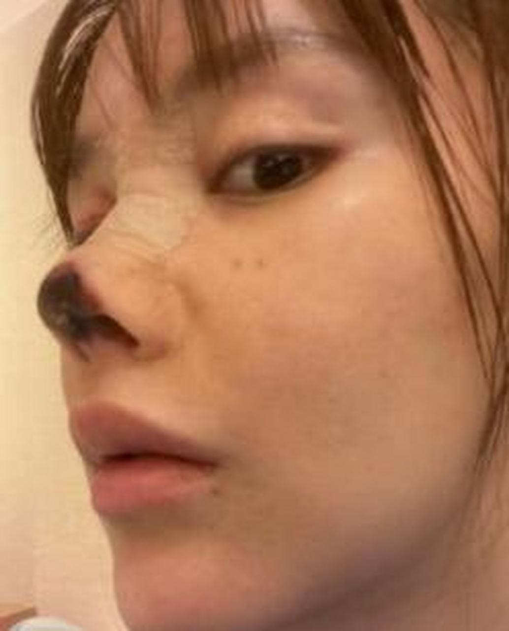 抢救无效后死亡,现在的网红容貌焦虑越来越强,整容医院更要加强管理