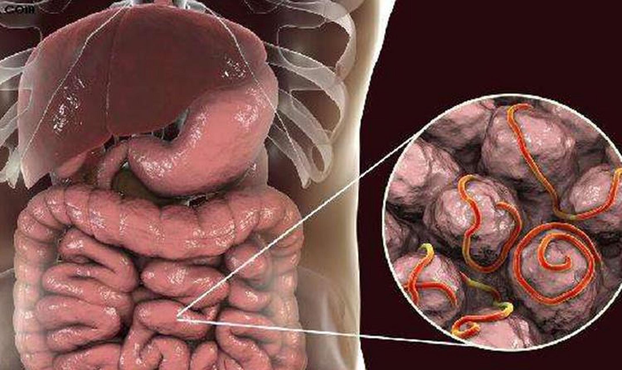 几十年前,在全国范围内流行的蛔虫病,为何现在几乎见不到了?