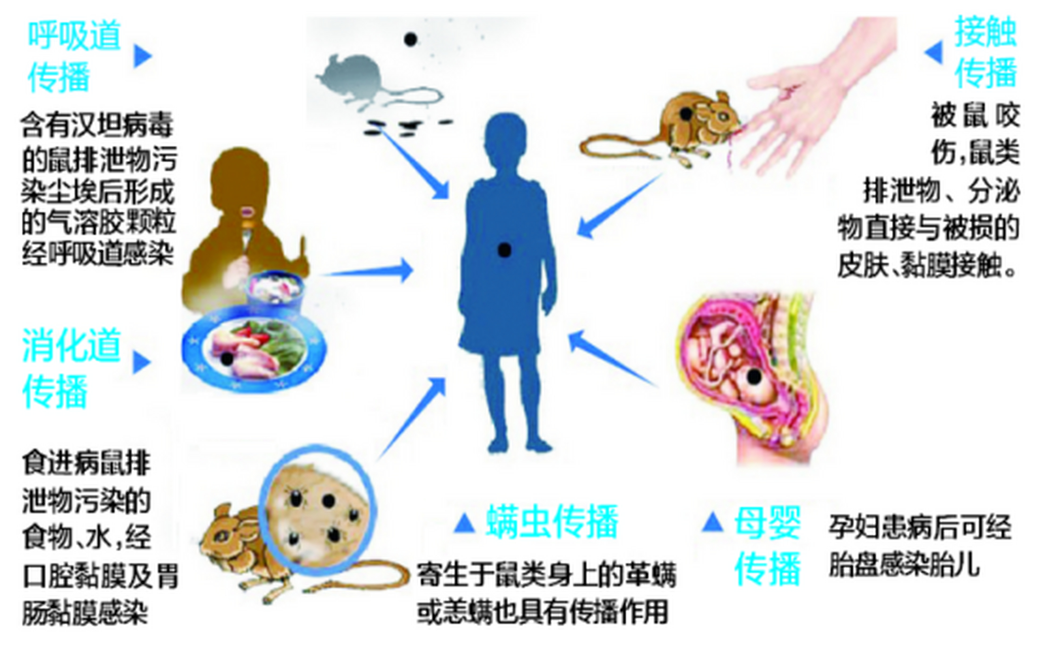 fever with renal syndrome, hfrs)全称为流行性出血热伴肾综合征