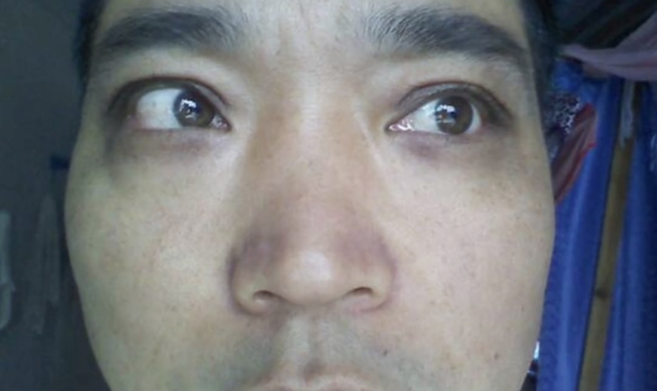 面色晦暗(脸色发黑,发黄,没光泽)  2.