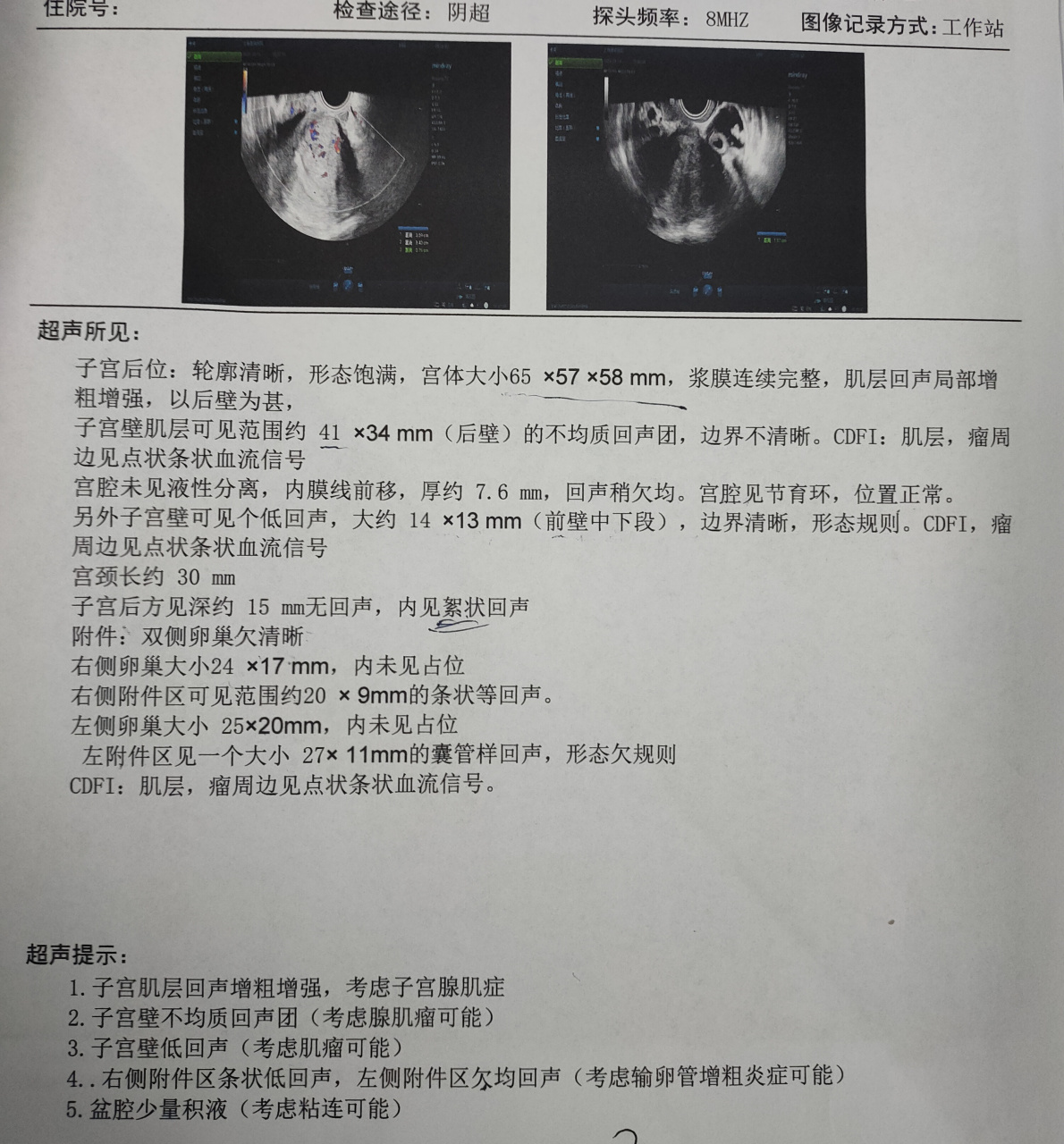 严重腺肌症试管成功率(严重腺肌症试管成功率多少)