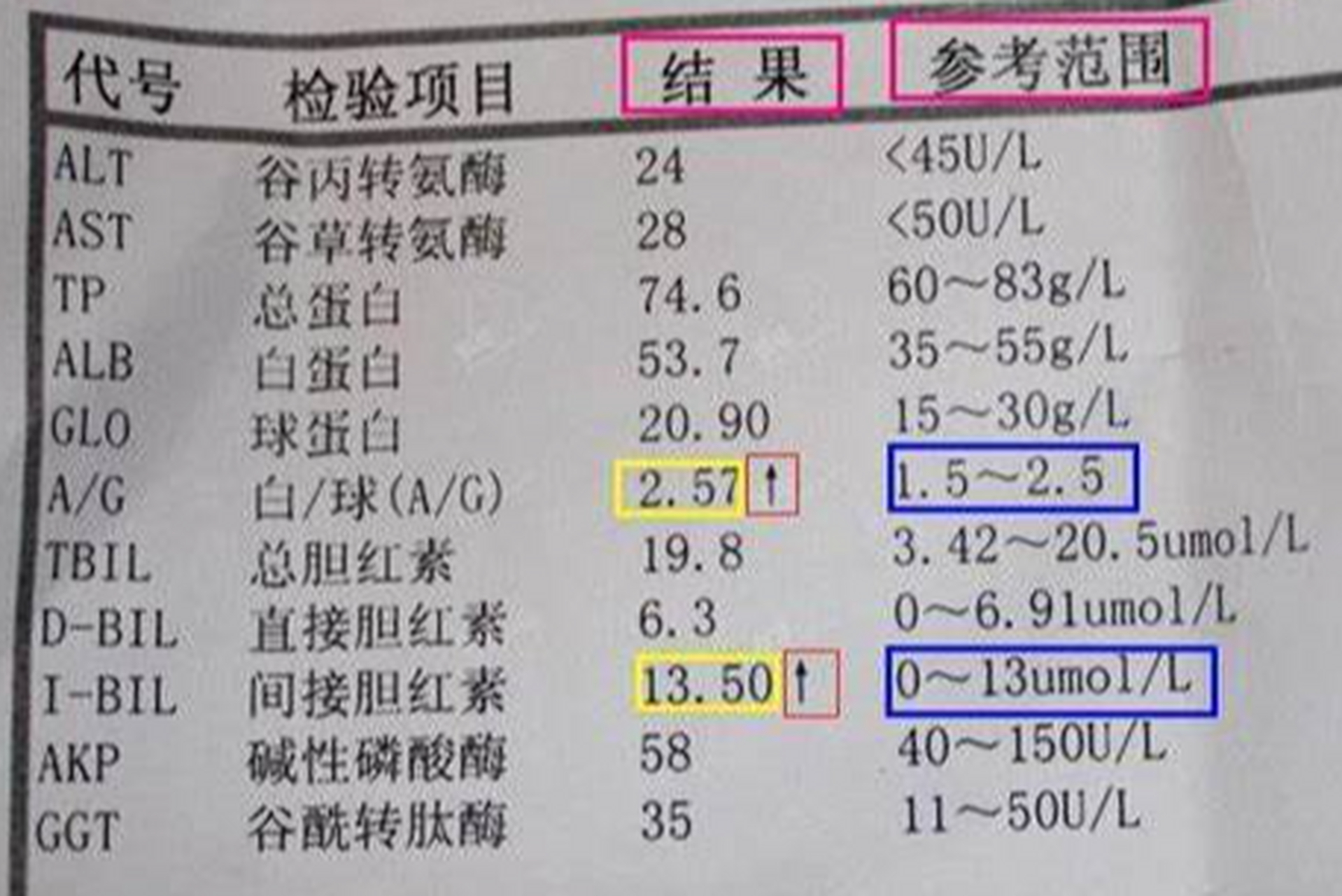读懂化验单:肝功能指标看五项!