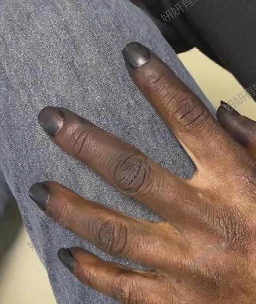 指甲再长点,我就要喊英叔来救场啦![哈哈]