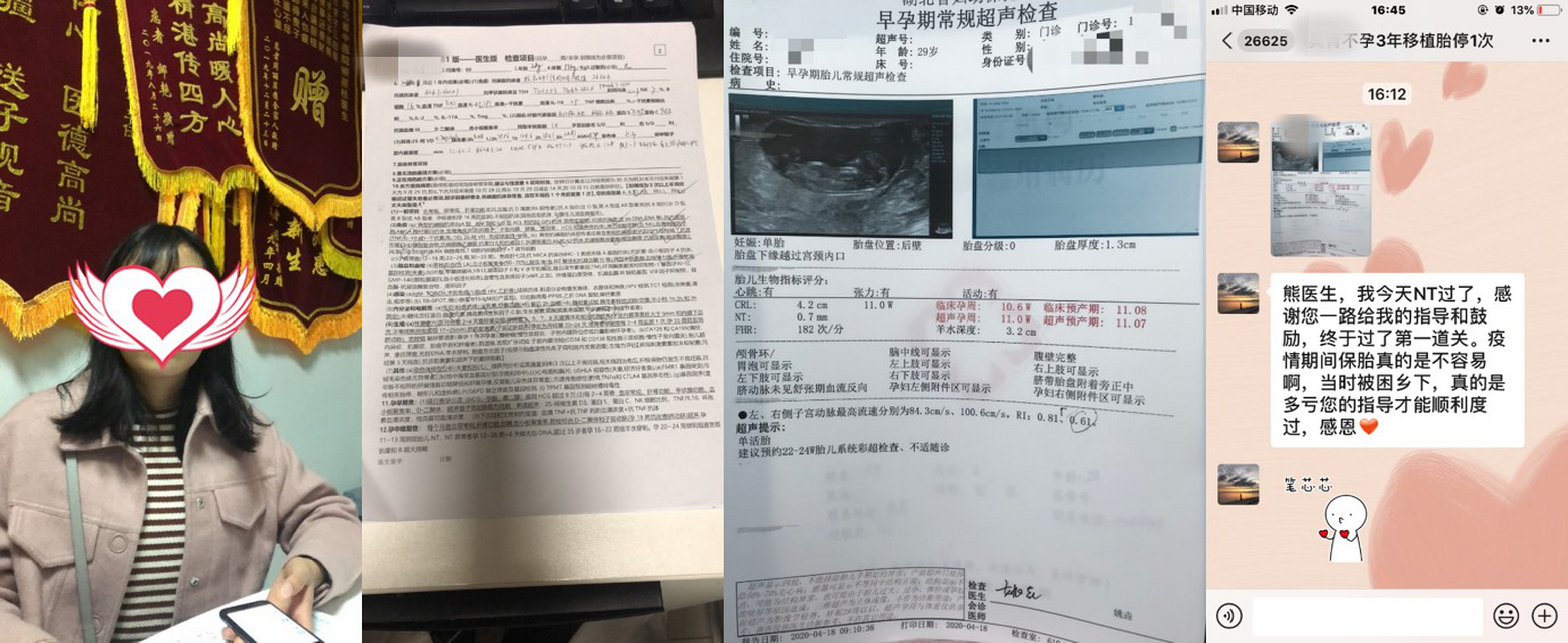 【每日一星2496-来自湖北省中医院熊丽桂主任 吴女士,29岁,湖北