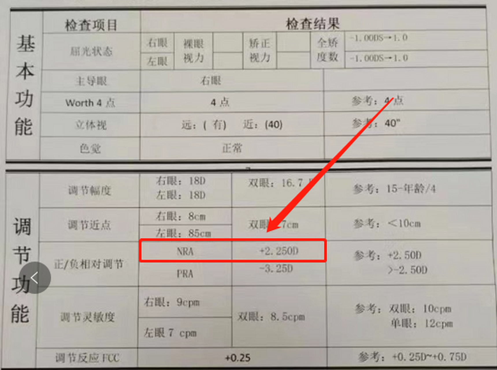 你會看視功能檢查嗎?