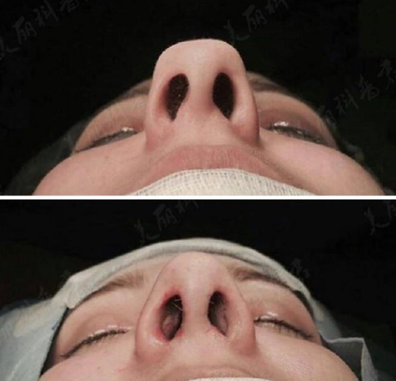 如果这鼻子长在一位女士的脸上,你们想象一下有多男性化!