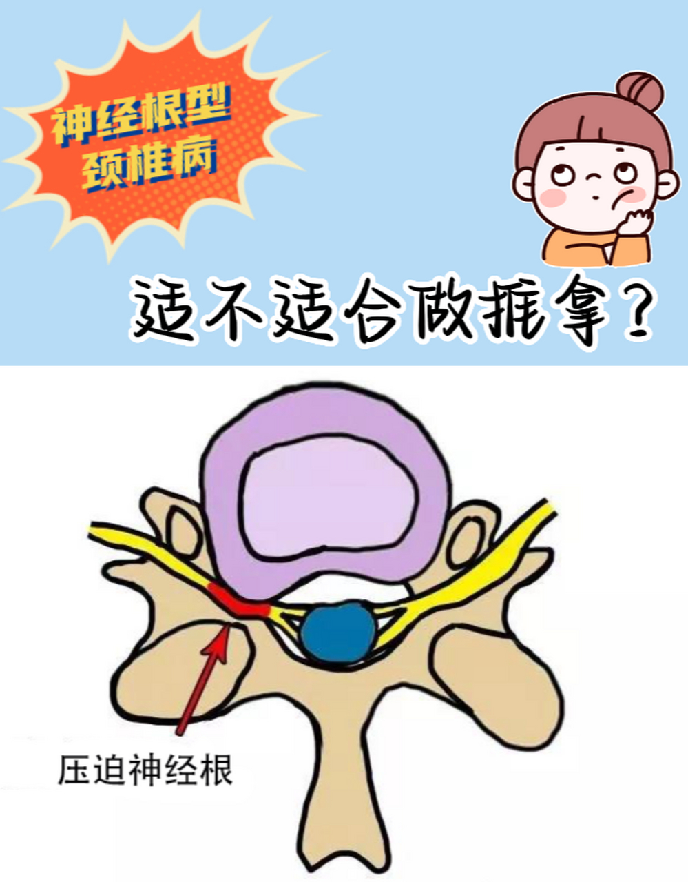 神经根型颈椎病是一种常见的颈椎疾病,通常会引起颈部疼痛,肩肭骨