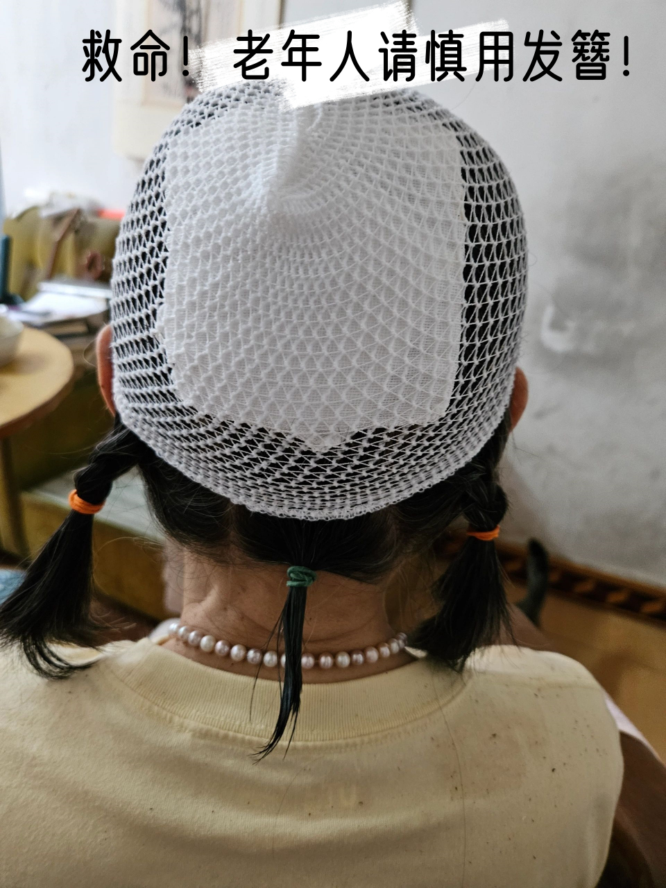 特别是供血不足摔倒的,头上的簪子很容易成为划伤头皮的利器如果不