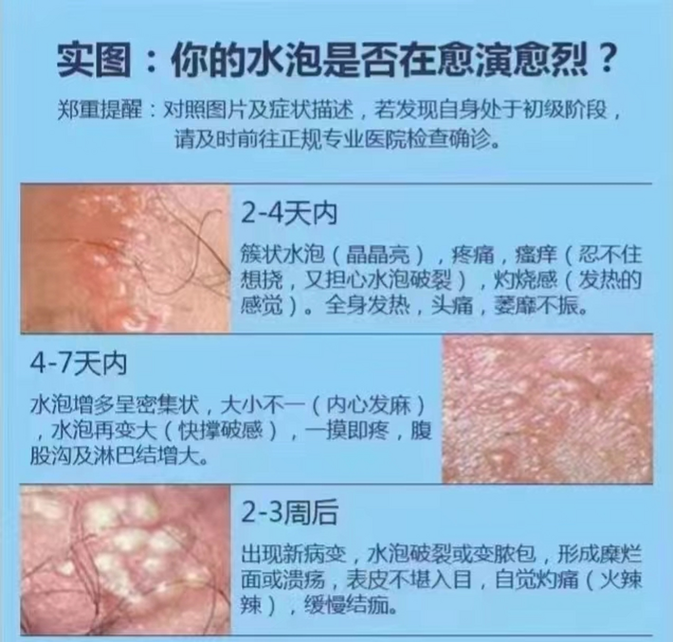 潍坊博大医院#博大医院男性小常识分享:男性龟头感染全面解析 龟头