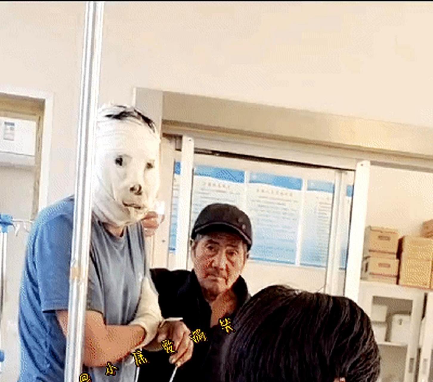 这个包扎的医生真的太搞笑了,他包扎出来的东西像一只狗!