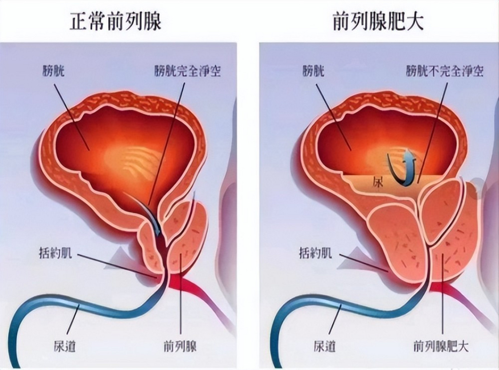 三個動作,讓你的前列腺越來越好,女生朋友記得讓你的男孩來看看.