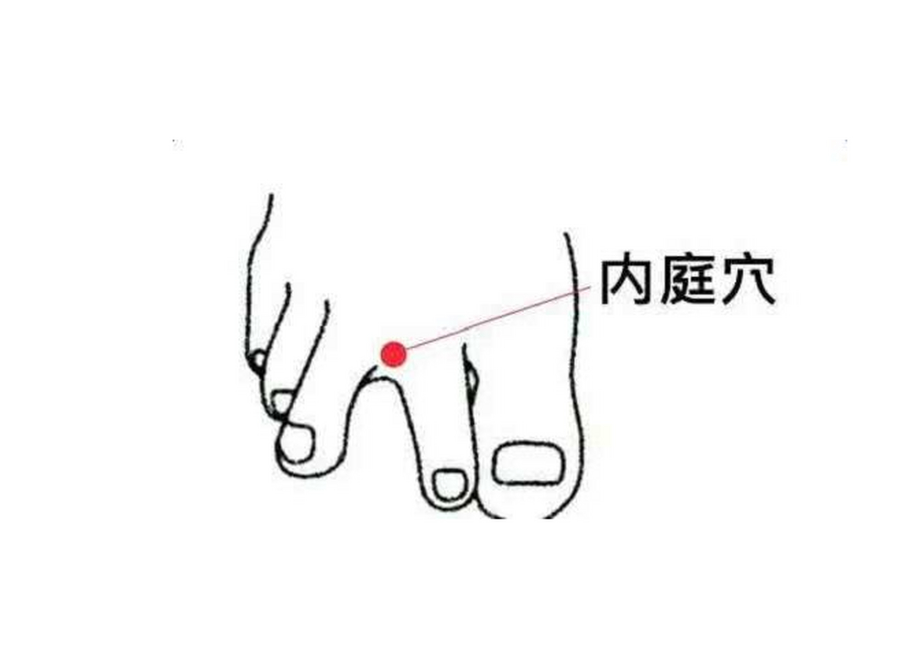 胃火的克星,按摩内庭穴祛胃火 中医认为,内庭穴最显著的一个特点就是