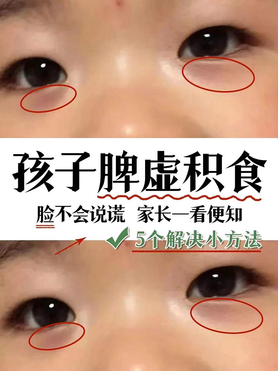 怎么知道孩子脾虚?