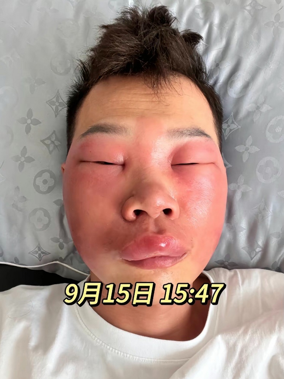 这个习惯就是抠鼻子